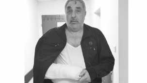 BAŞKAN AKBUĞA'NIN SAĞLIK DURUMU HAKKINDA AÇIKLAMA