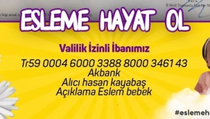 ESLEM BEBEK DESTEK DESTEK BEKLİYOR