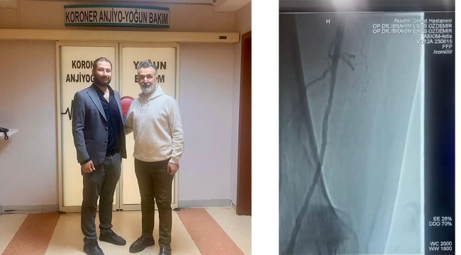 AKŞEHİR DEVLET HASTANESİNDE İLK BACAK ANJİYOSU 